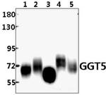 GGT5 Polyclonal Antibody