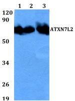 ATXN7L2 Polyclonal Antibody