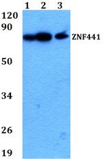 ZNF441 Polyclonal Antibody