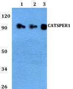 CATSPER1 Polyclonal Antibody