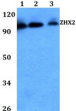 ZHX2 Polyclonal Antibody