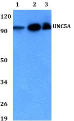 UNC5A Polyclonal Antibody