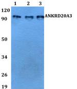 A20A3 Antibody in Western Blot (WB)