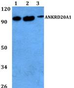 A20A1 Polyclonal Antibody