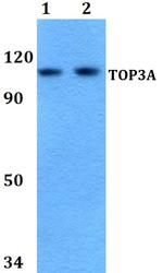 TOP3A Polyclonal Antibody