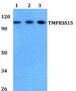 TMPRSS15 Polyclonal Antibody