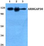 ARHGAP30 Polyclonal Antibody