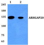 ARHGAP20 Antibody in Western Blot (WB)