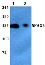 SPAG5 Polyclonal Antibody