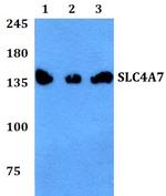 SLC4A7 Polyclonal Antibody