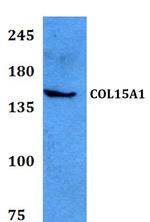 COL15A1 Polyclonal Antibody