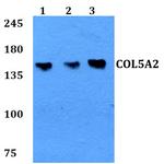 COL5A2 Polyclonal Antibody