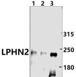 LPHN2 Antibody in Western Blot (WB)