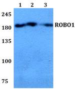 ROBO1 Polyclonal Antibody