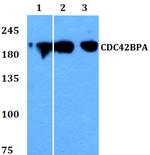 MRCK alpha Polyclonal Antibody