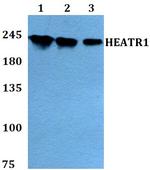 HEATR1 Polyclonal Antibody