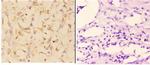 ABCA4 Polyclonal Antibody