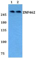 ZNF462 Polyclonal Antibody