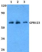 GPR123 Polyclonal Antibody