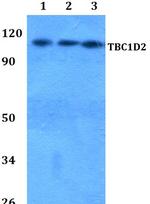 TBC1D2 Polyclonal Antibody
