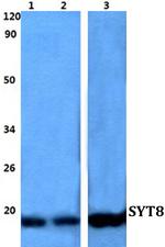 Synaptotagmin 8 Polyclonal Antibody