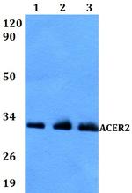 ACER2 Polyclonal Antibody