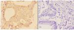 ADAM28 Antibody in Immunohistochemistry (Paraffin) (IHC (P))