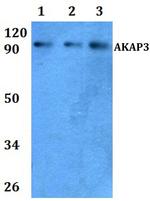 AKAP3 Polyclonal Antibody
