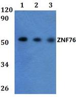 ZNF76 Polyclonal Antibody