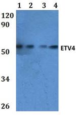 ETV4 Antibody in Western Blot (WB)