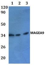 MAGEA9 Polyclonal Antibody