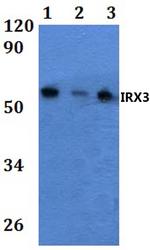 IRX3 Polyclonal Antibody