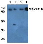 MLK2 Polyclonal Antibody