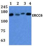 CSB Polyclonal Antibody