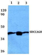 SDCCAG8 Polyclonal Antibody