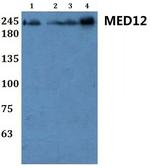 MED12 Polyclonal Antibody