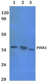 PINX1 Polyclonal Antibody