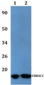CHRAC1 Polyclonal Antibody