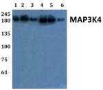 MEKK4 Polyclonal Antibody