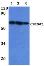 CYP26C1 Polyclonal Antibody