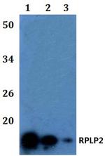 RPLP2 Polyclonal Antibody