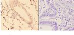 ACOT9 Polyclonal Antibody