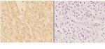 ADAMTS7 Polyclonal Antibody