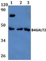 B4GALT2 Polyclonal Antibody