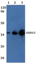 GLB1L3 Polyclonal Antibody