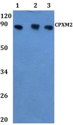 CPXM2 Polyclonal Antibody