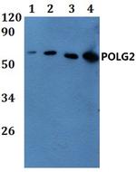 POLG2 Polyclonal Antibody