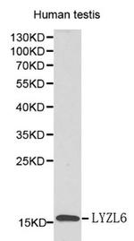 LYZL6 Polyclonal Antibody