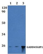 GADD45GIP1 Polyclonal Antibody