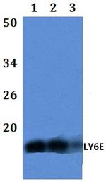 Ly-6E Polyclonal Antibody